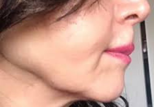 کلوئید طلا روشی نوین در افزایش کلاژن‌سازی پوست